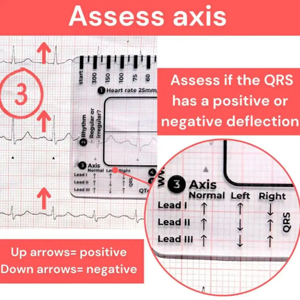 Ecg 7 passo régua portátil batimento cardíaco ecg observação transparente 7 passos escala ferramenta de medição régua para interpretação ecg