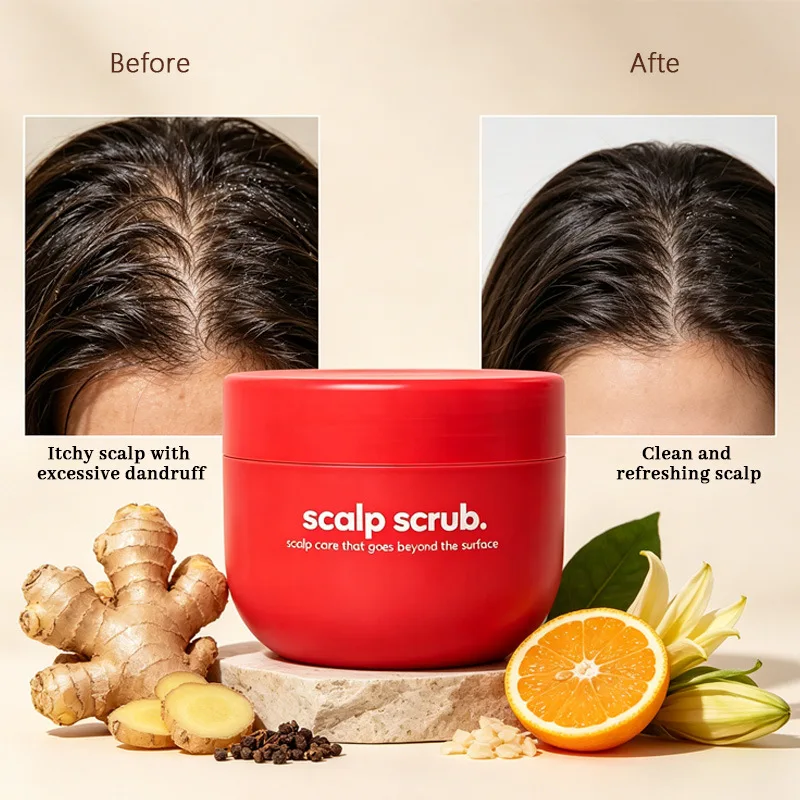 Exfoliating Scalp Scrub Shampoo 150ml – Clarifying Treatment Removes Buildup & Flakes, Nourishes Hair for Silky Softness