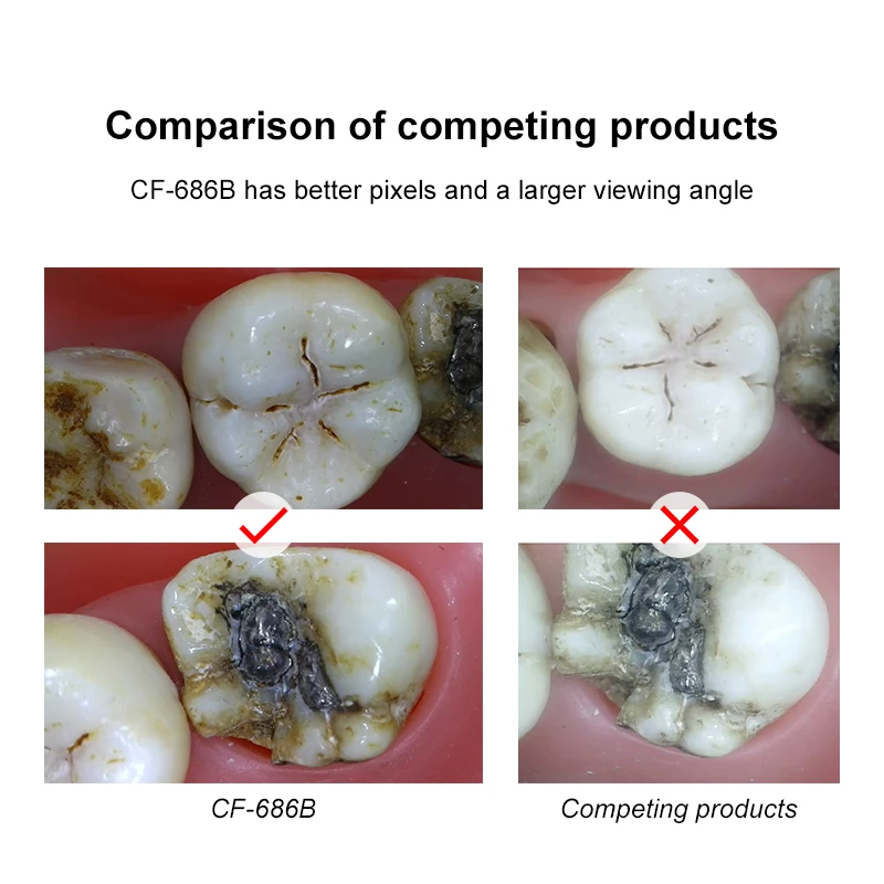 

Стоматологическая интраоральная камера VV Dental 13 МП с мгновенной передачей изображения и интеллектуальным фокусом, 4K, USB, с индукционным кронштейном CF-686B
