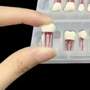 4Box Dental Teeth Root Canal Model Endodontic RCT Block Pulp Cavity Practice Model Study Endo Student Train Study Resin Replace