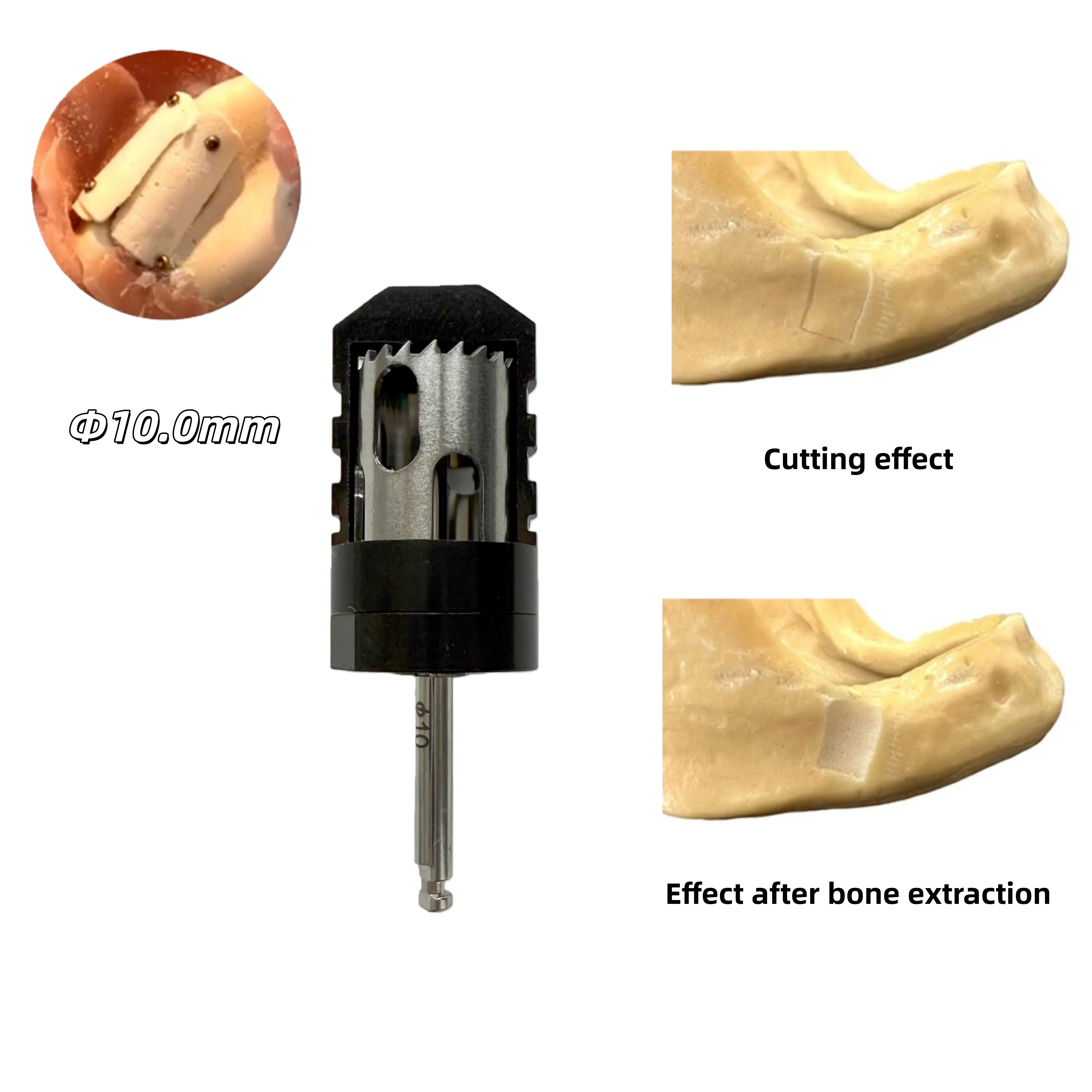 taladro-de-muestreo-de-hueso-de-medio-mes-dental-injerto-de-hueso-perforacion-de-rebanadas-de-hueso-taladro-de-anillo-para-implante-dental-Φ100mm