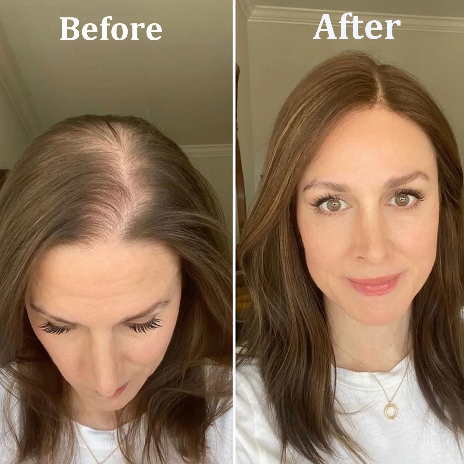 16" Blonde Human Hair Toppers Dark Roots For Women Brown Hair Piece Straight Hair Clip In Toppers Extensions For Woman Toupee