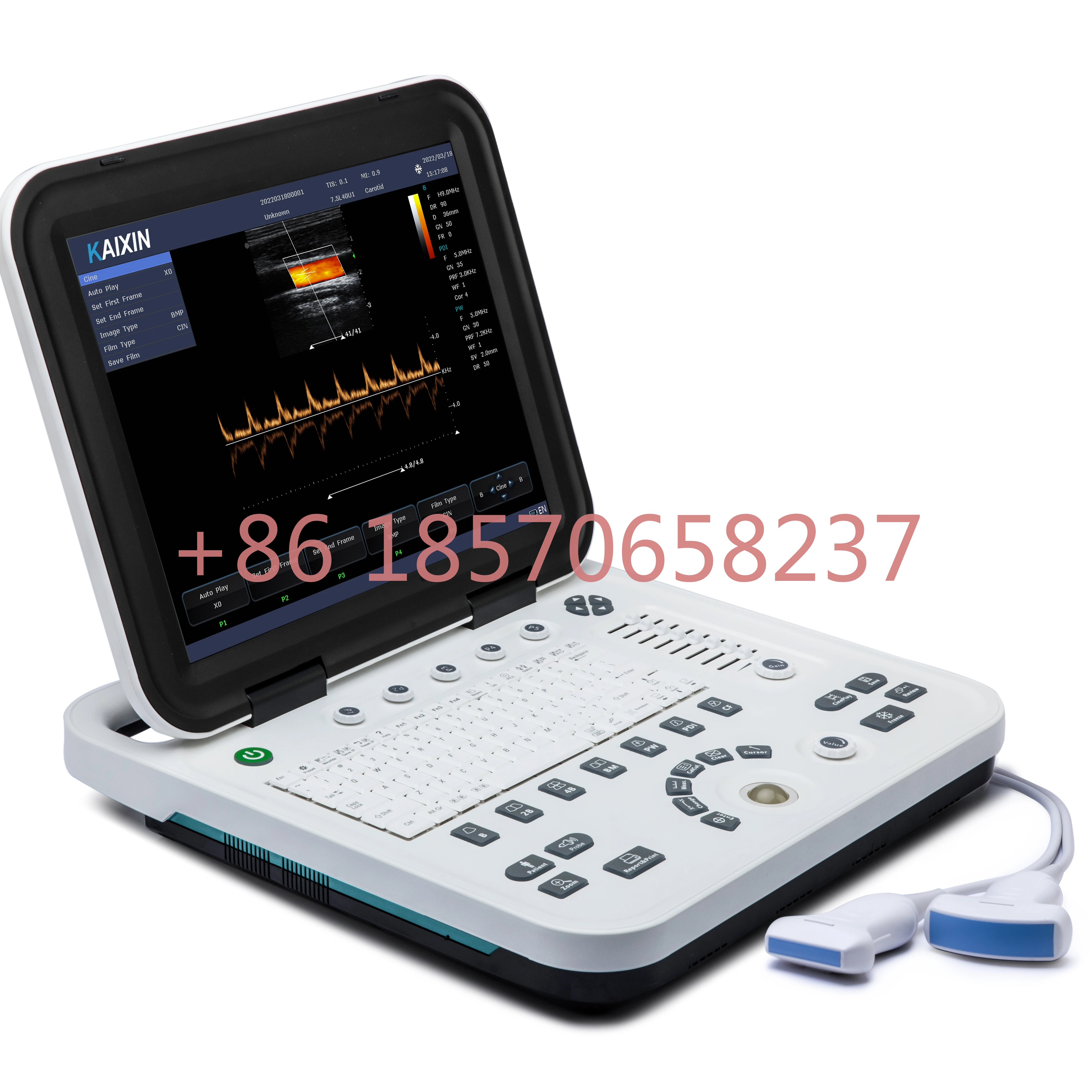 Ku1 Ultrasound machine 15 