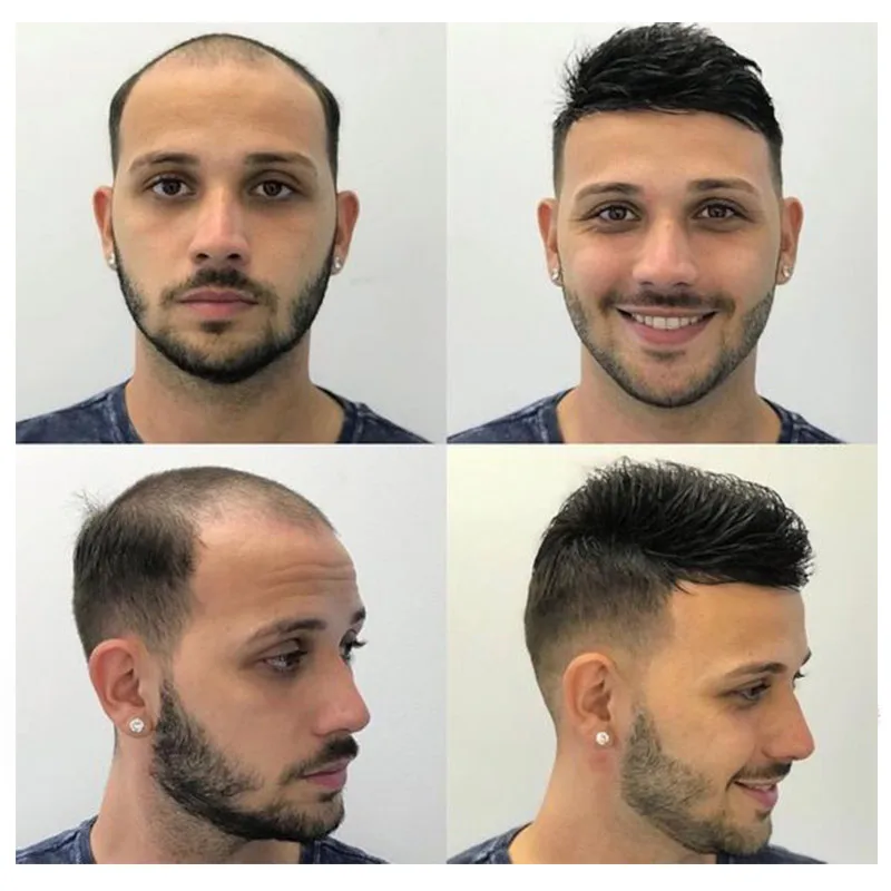 Mono e pele capilar peruca de cabelo humano para homens, prótese de cabelo masculino, toupee, unidade do sistema de substituição do cabelo, peruca realista