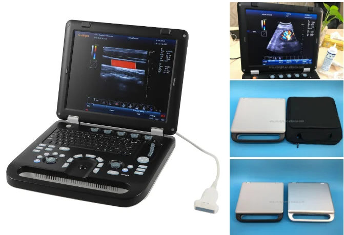 Portable laptop Color Ultrasound Scanner 3D Machine Notebook type ultrasound