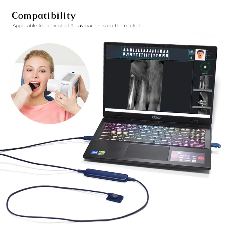 Dental Sensor X-Ray High-Frequency Rx Digital Intraoral Digital System H D Image Radiovisografo Dental Digital Sensor