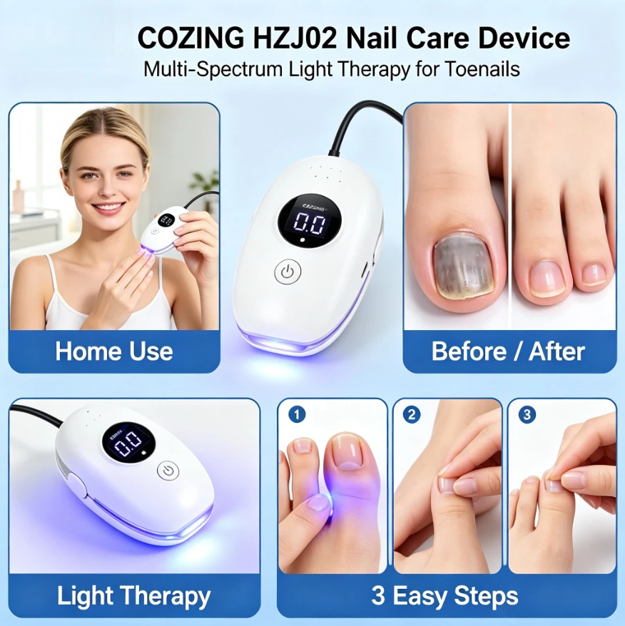 Onychomycosis Therapy Cure Machine Effectively Remove Toenail Fingernail Fungus – Nail Fungus Laser Treatment Device Repair