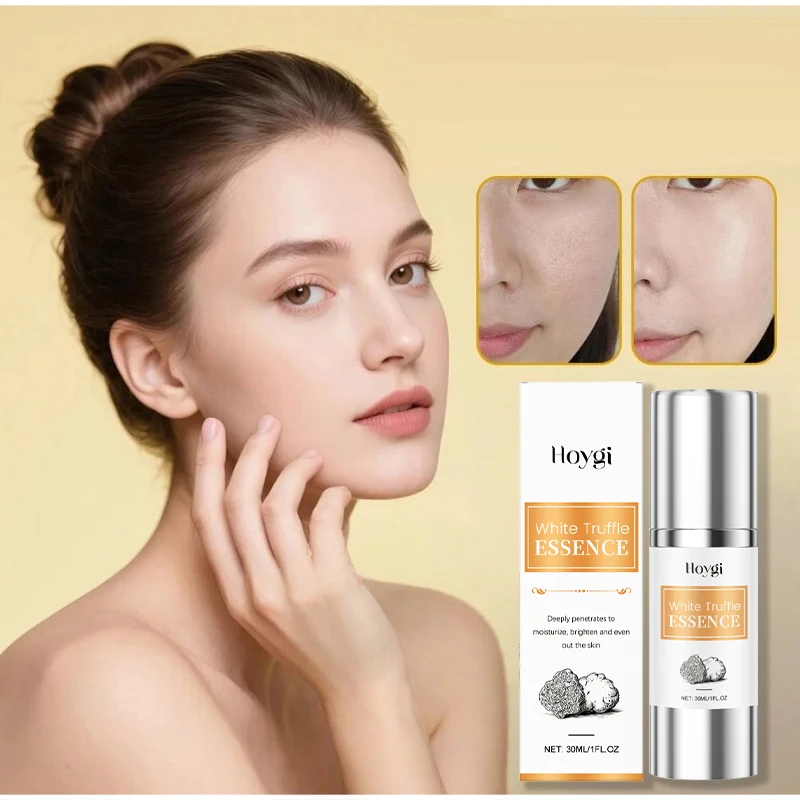 

Корейский белый трюфель, увлажняющая эссенция, молочко, увлажняющее средство для лица, легкое увлажнение, мягкая, эластичная кожа