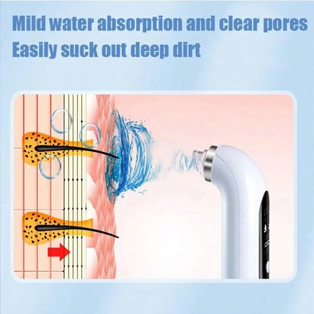 블랙헤드 제거제, 모공 진공 페이셜 클리너, 전기 여드름 제거제, 블랙헤드 제거제, USB 충전