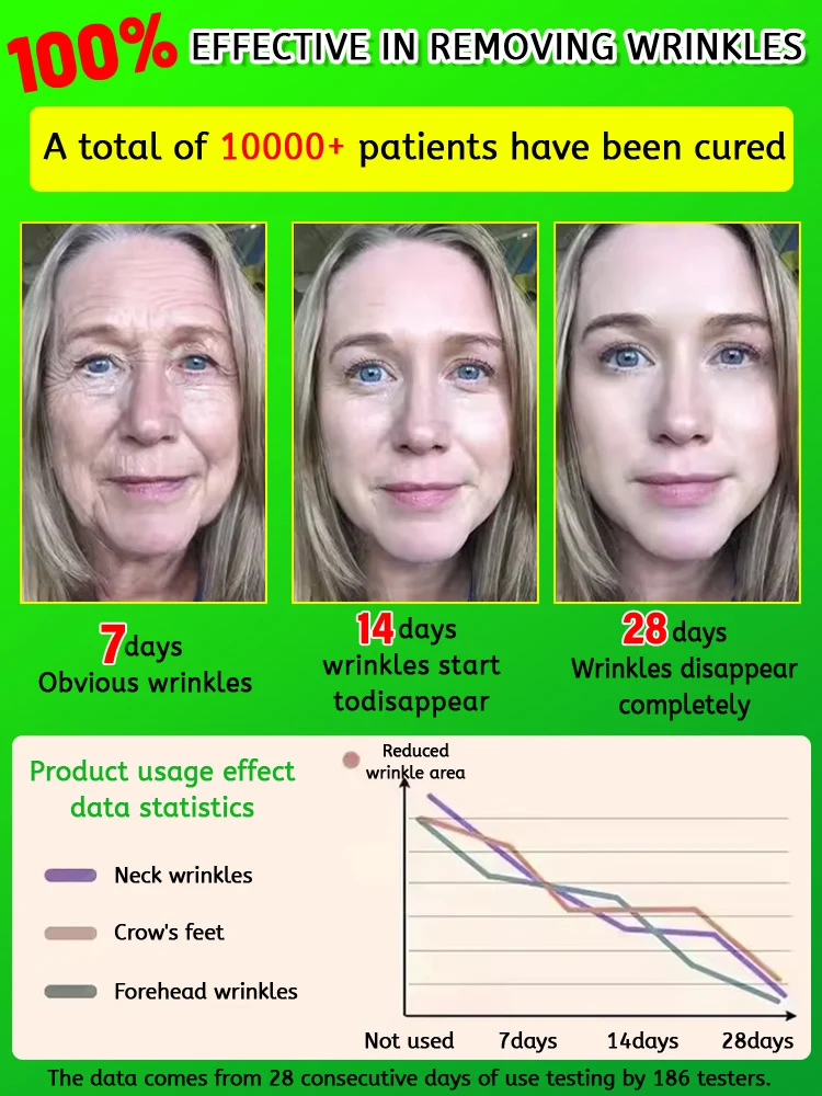 [Magia antienvejecimiento] Esencia antiarrugas levanta y reafirma para eliminar líneas finas y bolsas para los ojos