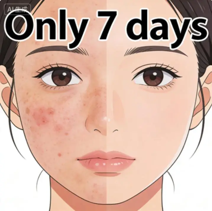 Top selling list! 7-day effect, darkening acne prone skin → smooth and good condition
