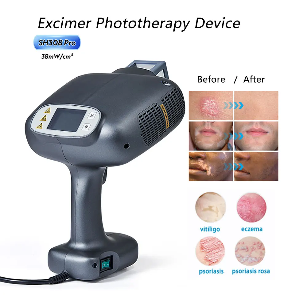 

Excimer Phototherapy Device 308nm Ultraviolet Lamp Laser for Vitiligo Psoriasis White Spot EAC Urticaria Skin Pruritus Disease