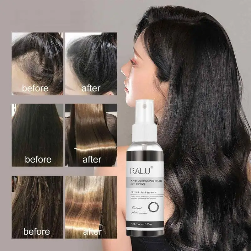 

100ml Hair Growth Spray Natural Hair Growth Oil Anti Hair Loss Serum Prevent Baldness Scalp Dry Damaged Hair Care Oil