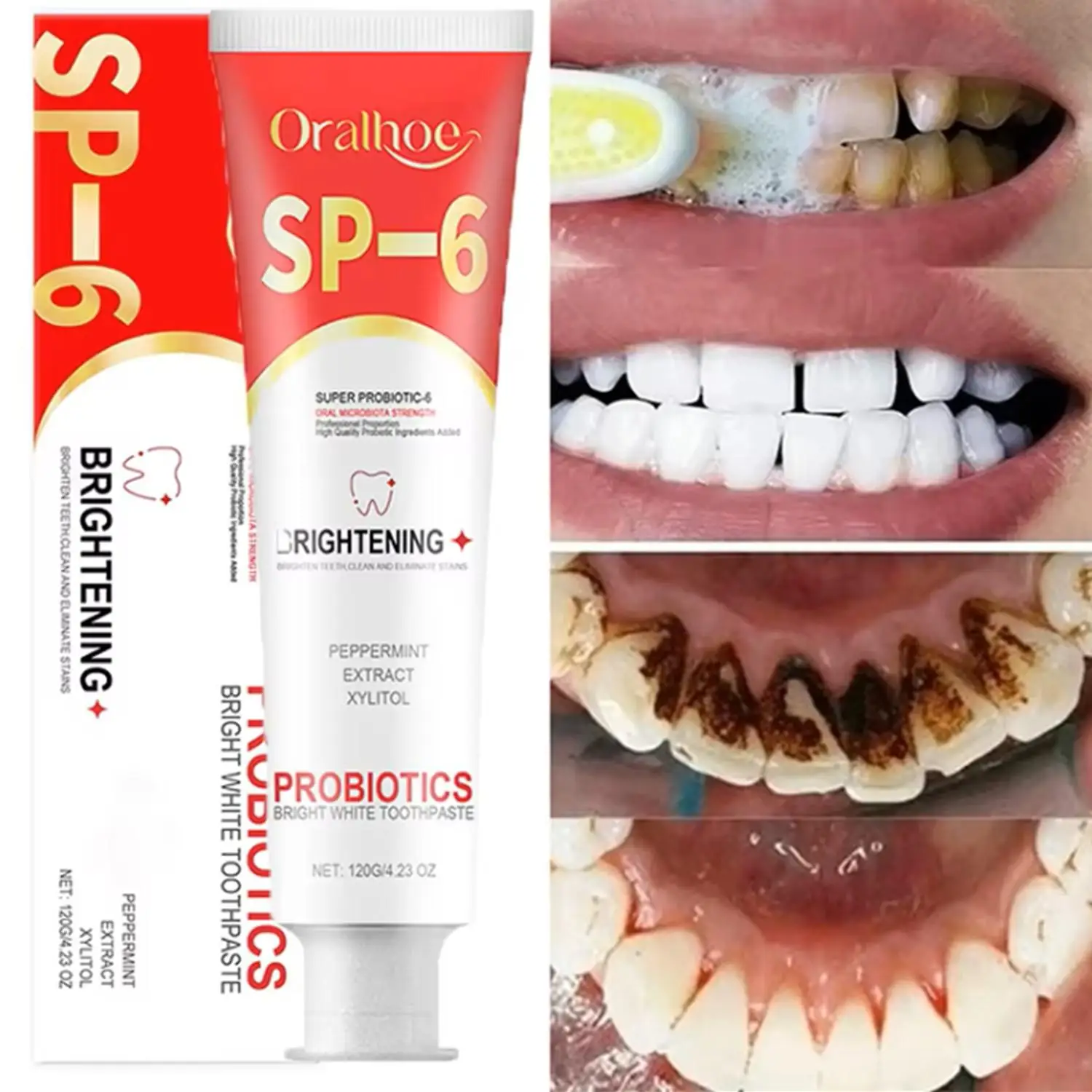 SP-6 Dentifricio probiotico Sbiancare i denti puliti Rimuovere le macchie Gestione dell'igiene orale Alito fresco con saccharino di sodio Lattobacillus