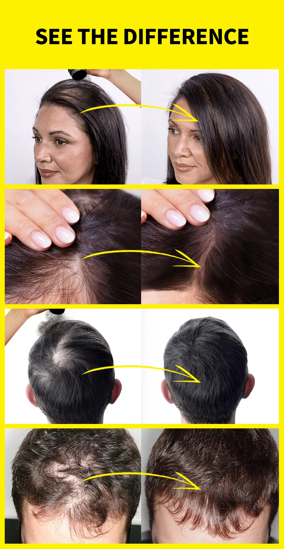 Sevich Haarverdichtungs-Faser-Set 12g Sofort-Haarwuchs-Verdickungspulver Dichtes Haarspray-Applikator Unisex Haarausfall-Produkte – Detail 8