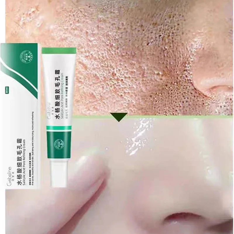 Salicylic Acid Face Serum Remove Acne Blackhead Quick Shrink Pore Whitening Cream Moisture Oil Control Korean Skincare Cosmetic