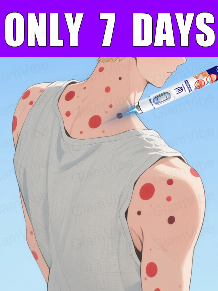 

blue light pen solve warts, hot sale wart care tools