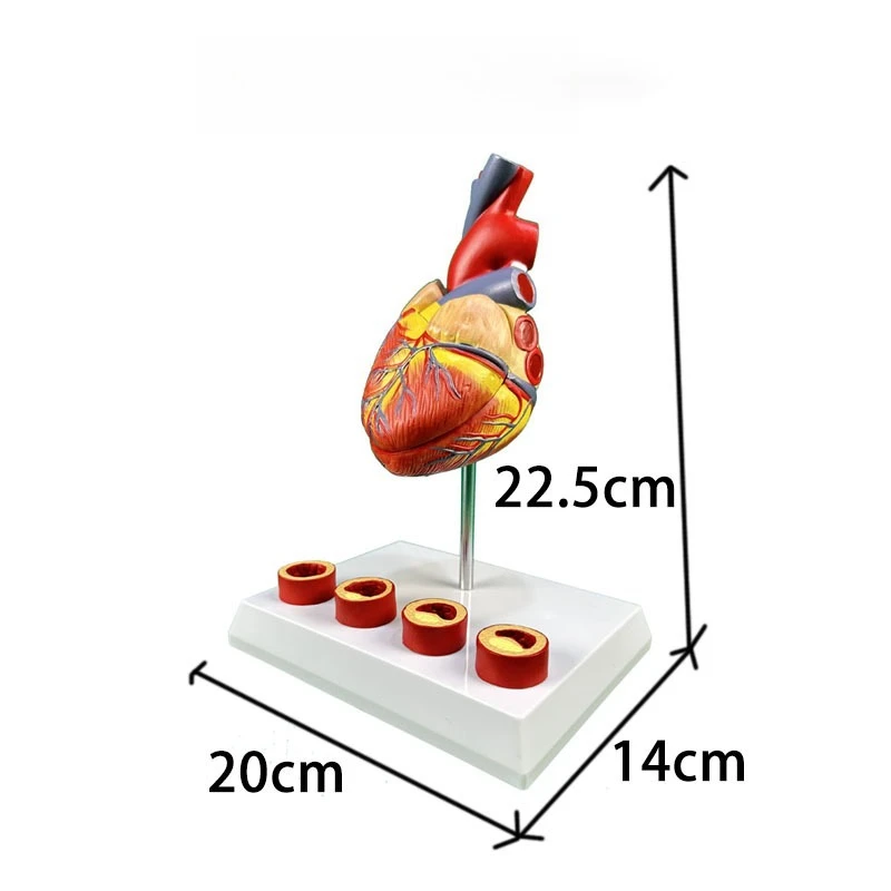 Large natural heart zone thrombosis medical teaching and training model