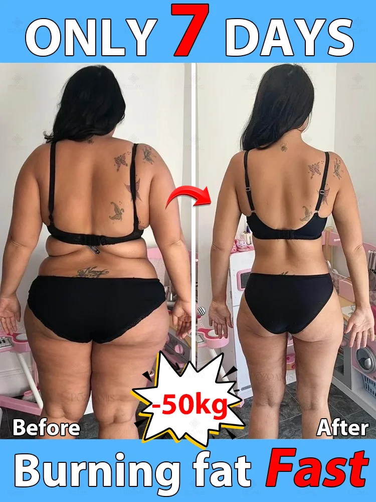 ᴱᶠᶠᵉᶜᵗⁱᵛᵉ ᔆˡⁱᵐᵐⁱⁿᵍ ᴾᵃᵗᶜʰ ᶠᵒʳ ᶠᵃᵗ ᴮᵘʳⁿ⸴ ᴮᵉˡˡʸ⸴ ᴬʳᵐˢ⸴ ᴸᵉᵍˢ ᶠᵃᵗ ᴿᵉᵈᵘᶜᵗⁱᵒⁿ⸴ ᴮᵒᵈʸ ᔆʰᵃᵖⁱⁿᵍ