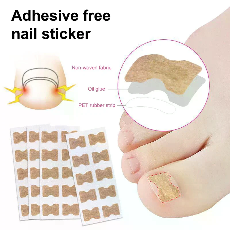 Ensemble d'autocollants professionnels pour correcteur d'ongles incarnés, soins des ongles des orteils, outils de pédicure, soins de santé, protection du traitement Paronychia