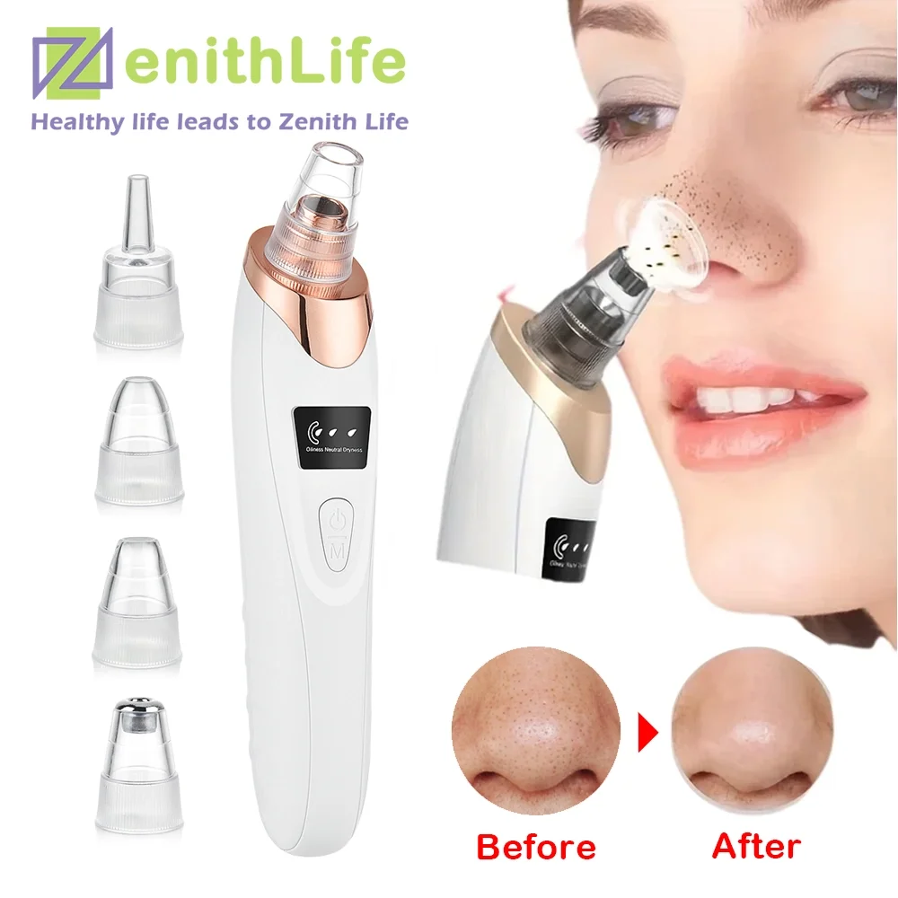 

Blackhead Remover Pore Vacuum Face Cleaner Electric Pimple Acne Black Head Removal USB Rechargeable 2025 New Black Dot Remove