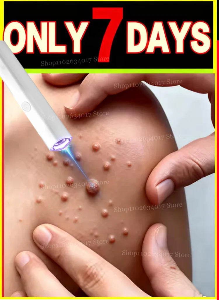 

2nd ᵍᵉⁿᵉʳᵃᵗⁱᵒⁿ ᵘᵖᵍʳᵃᵈᵉᵈ wᵃʳᵗ ⸴ ᑫᵘⁱᶜᵏˡʸ， ʳᵉpᵃⁱʳ wᵃʳᵗˢ ʳᵒoᵗ ，2025