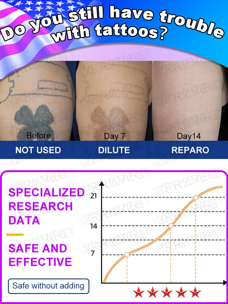 A ʟᴀsᴇʀ ᴘᴇɴ ᴛʜᴀᴛ ᴇғғᴇᴄᴛɪᴠᴇʟʏ ʀᴇᴍᴏᴠᴇs ᴛᴀᴛᴛᴏᴏs