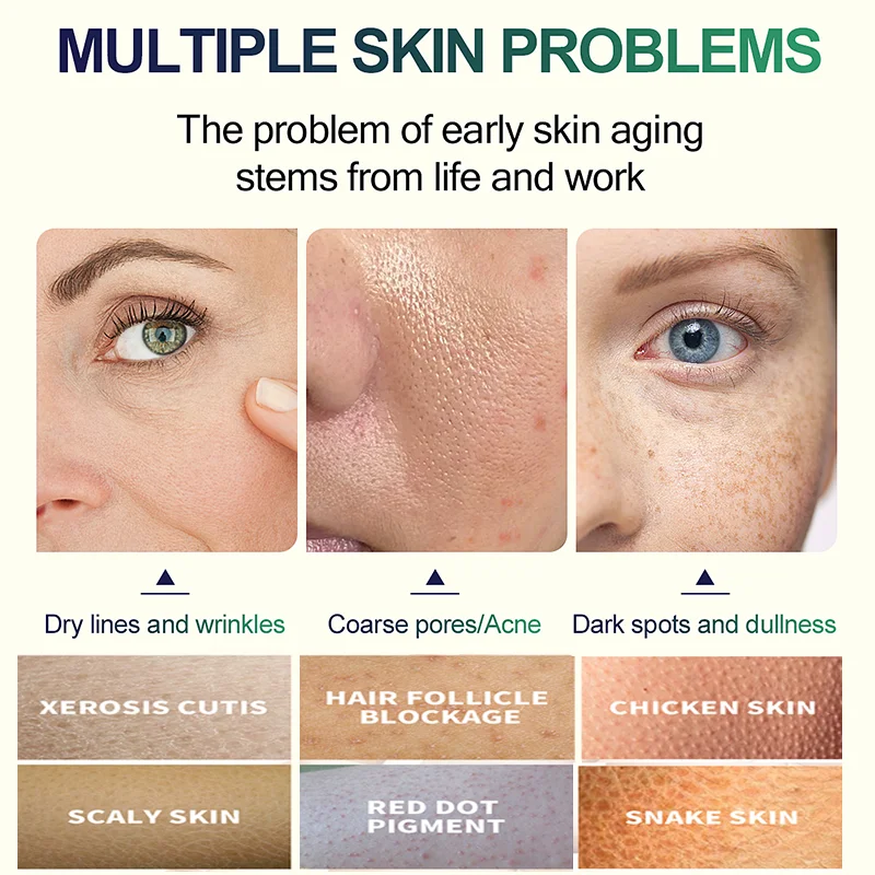 Feuchtigkeitsspendende Bleaching Nährende Reparatur Peeling Peeling Öl Gesichts Peeling Peelings Gesichts Creme Schönheit Hautpflege Peeling Gesichts