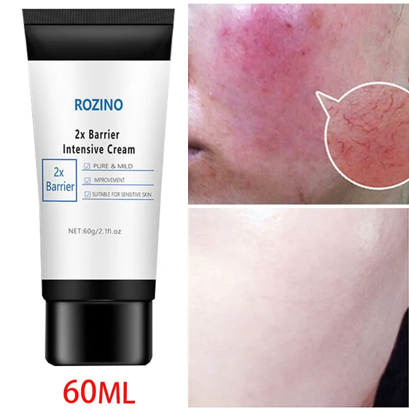 Facial Redness Repair Cream Improve Sensitive Skin Redness Rosacea Itching Instant Spider Vein Treatment Anti Aging Skin Care