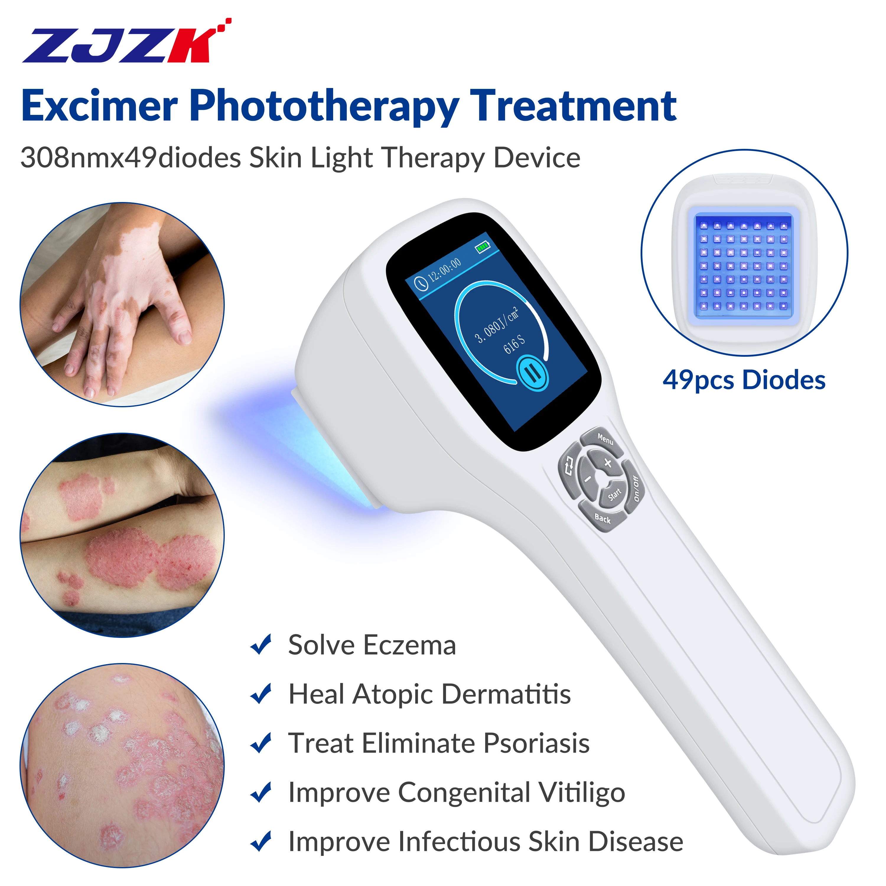 ZJZK UVB Light Therapy At Home Eczema Slight Vitiligo 308nmx49diodes Benefits Of Blue Light For Skin Pigmented Skin Disease