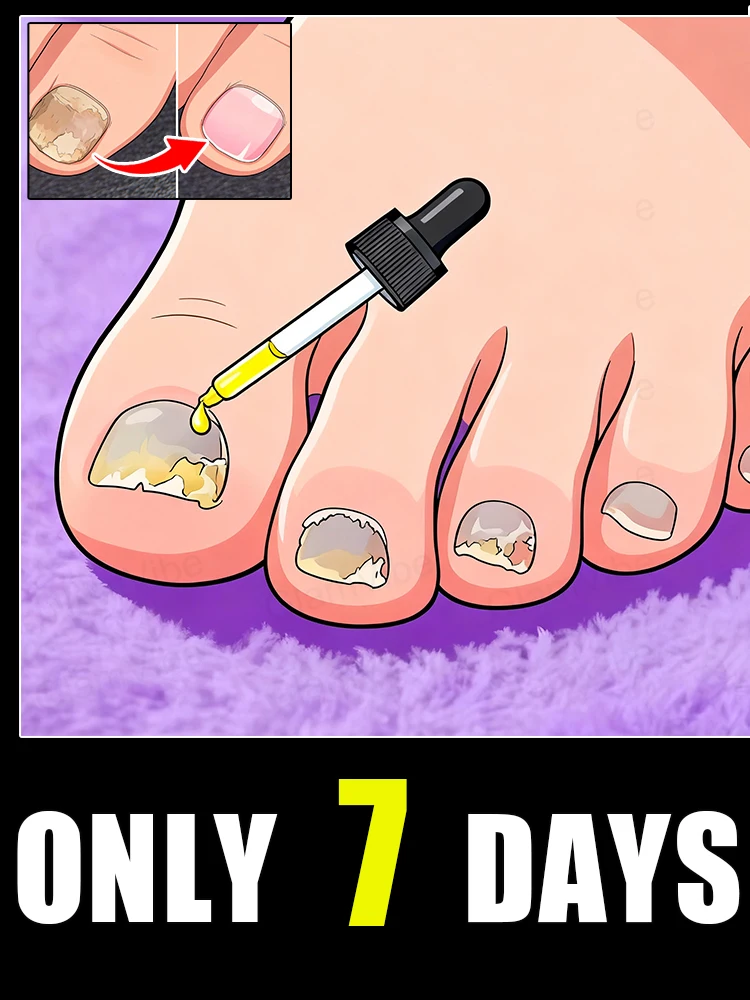 

ᑫᵘⁱᶜᵏ ᵀʳᵉᵃᵗᵐᵉⁿᵗ⸴ ᔆᵃʸ ᴳᵒᵒᵈᵇʸᵉ ᵗᵒ ᶠᵘⁿᵍᵃˡ ᴺᵃⁱˡ ᵂᵒʳʳⁱᵉˢHot-selling nail cleaning brush