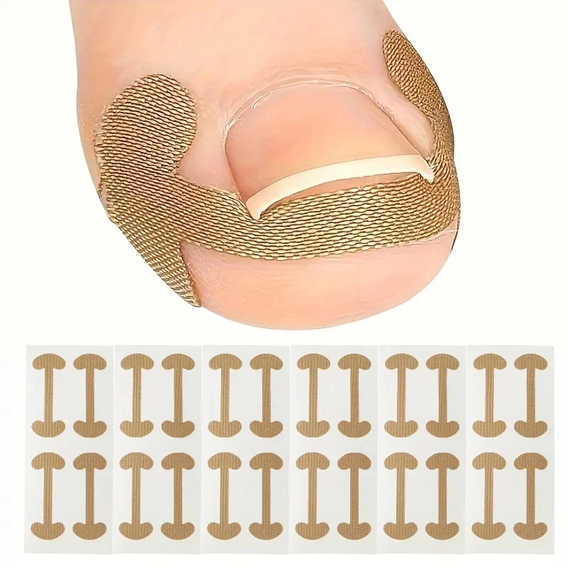 Ingrown Toenail Correction Strips Lasting Adhesion Waterproof Nail Correction Stickers Elasticity Toe Care Pedicur