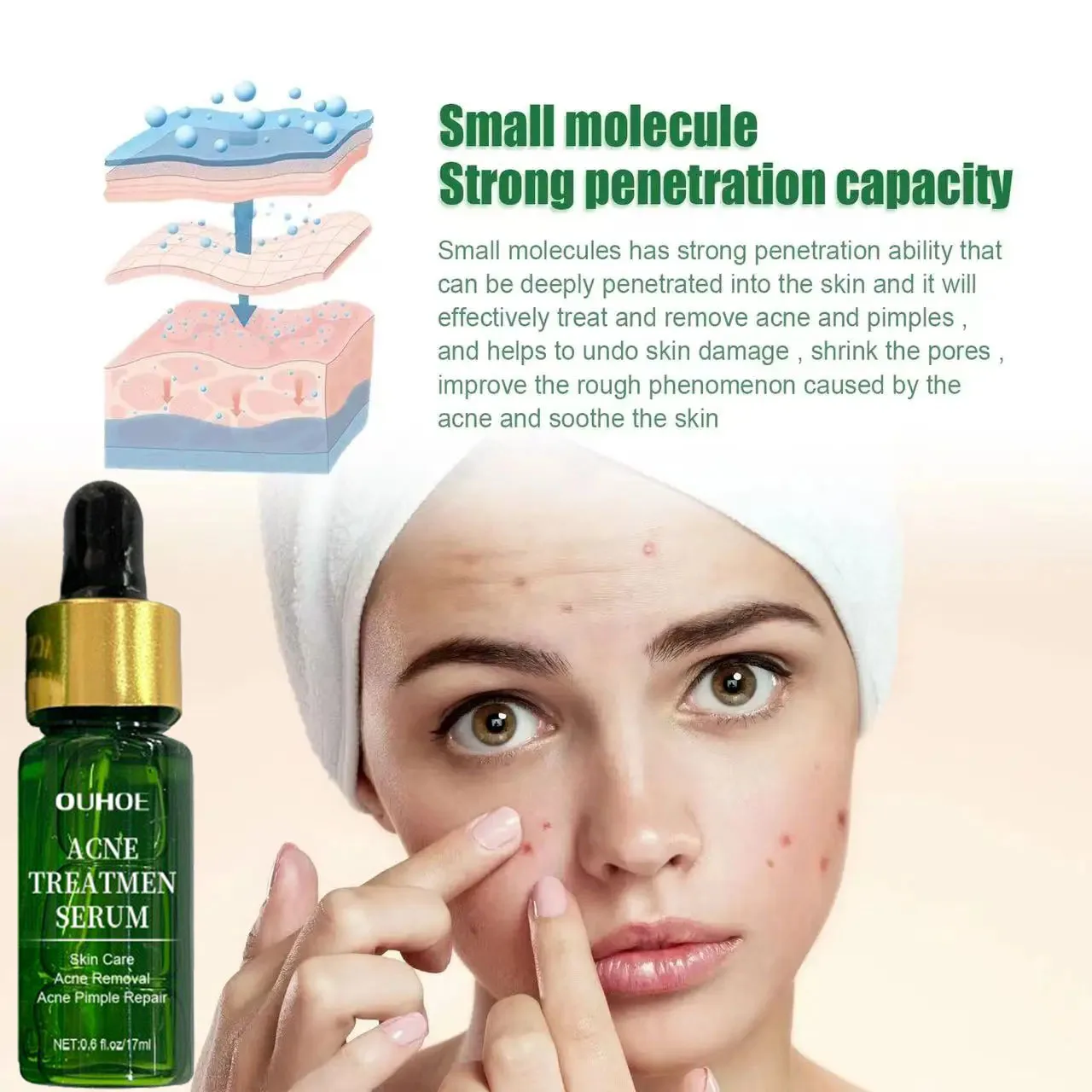 Acne Behandeling Gezicht Serum Porie Krimpende Huidverzorging Tegen Gezicht Acne Puistje Vlekken Verwijderaar Cleaning Krimpt Poriën Tea Tree Serum