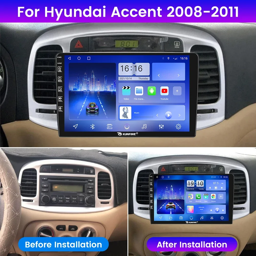 2Din Android Car Radio For Hyundai Accent 2008-2011 Multimedia Video Player GPS Navigation Stereo Audio Head Unit Carplay 4G