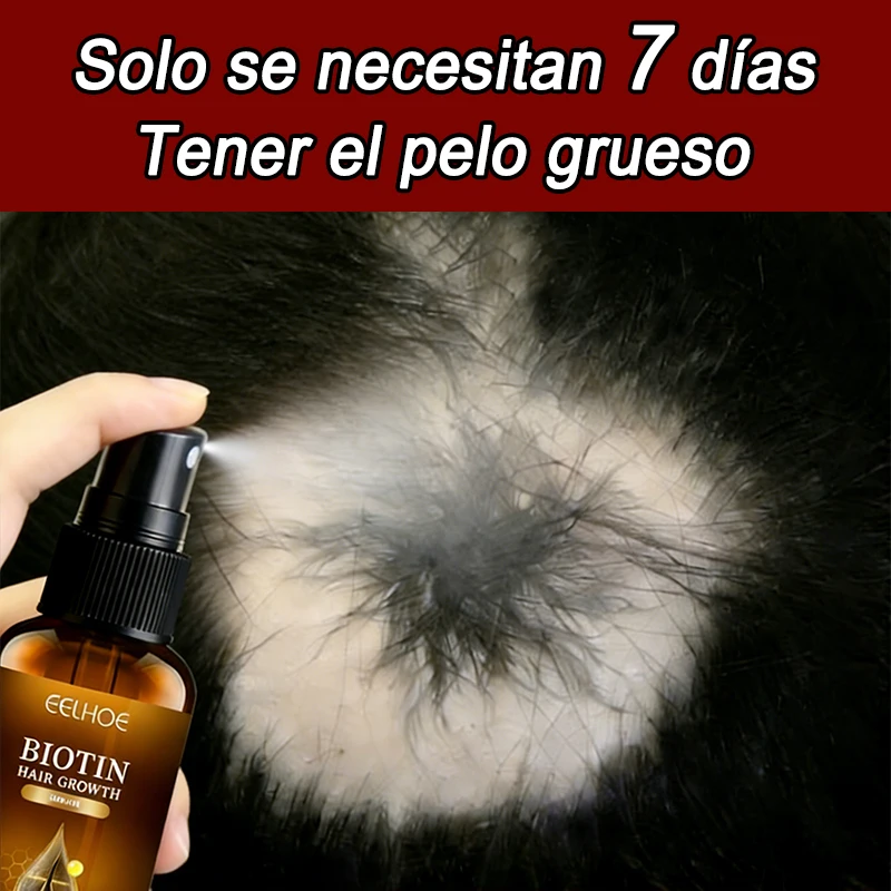 

Спрей для роста волос с биотином: быстрый рост, восстановление, устранение пушистости, лечение поврежденной кожи головы, укрепление корней волос, питательная эссенция для ухода за волосами