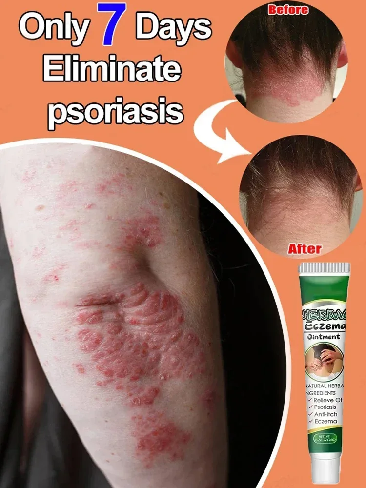 Π Π°Π·Π³Π»Π°Π΄ΡΡΠ΅ ΠΊΠΎΠΆΡ ΠΈ ΠΠΎΠΏΡΠΎΡΠ°ΠΉΡΠ΅ΡΡ Ρ Π·ΡΠ΄ΠΎΠΌ ΠΈ ΠΏΡΠΎΠ±Π»Π΅ΠΌΠ°ΠΌΠΈ ΠΊΠΎΠΆΠΈ ΠΈ Π²ΠΎΡΡΡΠ°Π½ΠΎΠ²ΠΈΡΠ΅ ΡΠ²Π΅ΡΠ΅Π½Π½ΠΎΡΡΡ Π Π°Π·Π³Π»Π°Π΄ΡΡΠ΅ ΠΊΠΎΠΆΡ ΠΈ ΠΠΎΠΏΡΠΎΡΠ°ΠΉΡΠ΅ΡΡ Ρ Π·ΡΠ΄ΠΎΠΌ ΠΈ ΠΏΡΠΎΠ±Π»Π΅ΠΌΠ°ΠΌΠΈ ΠΊΠΎΠΆΠΈ ΠΈ Π²ΠΎΡΡΡΠ°Π½ΠΎΠ²ΠΈΡΠ΅ ΡΠ²Π΅ΡΠ΅Π½Π½ΠΎΡΡΡ