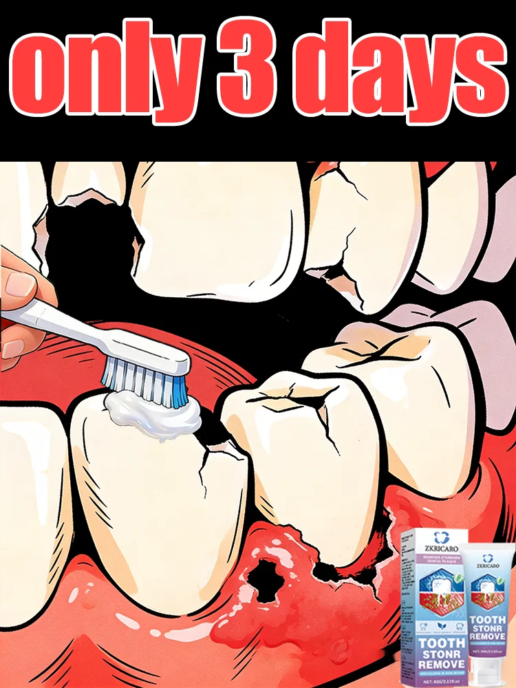 

2nd generation new upgrade, tartar remover dissolves tartar and removes stains