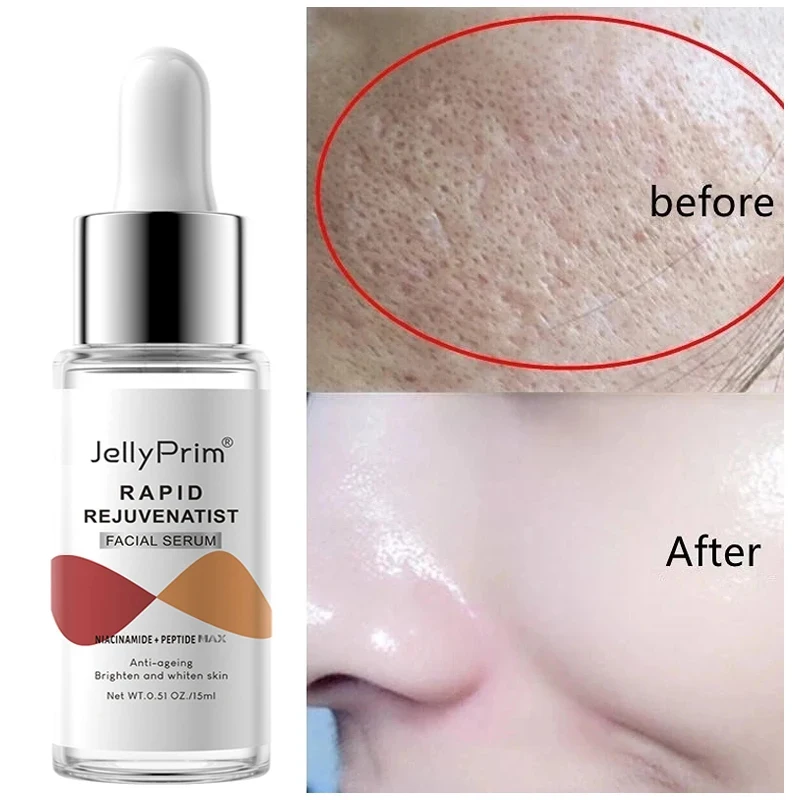 Niacinamide Serum Donkere Vlek Verwijderaar Gezicht Serum Whitening Voor Gloeiende Porie Krimpende Hyaluronzuur Collageen Gezichtsverzorging