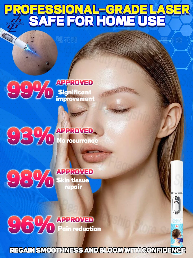 إزالة الثآليل الضوئية، استعادة البشرة الناعمة، إزالة الثآليل الدقيقة، فعالة وخالية من القلق #4