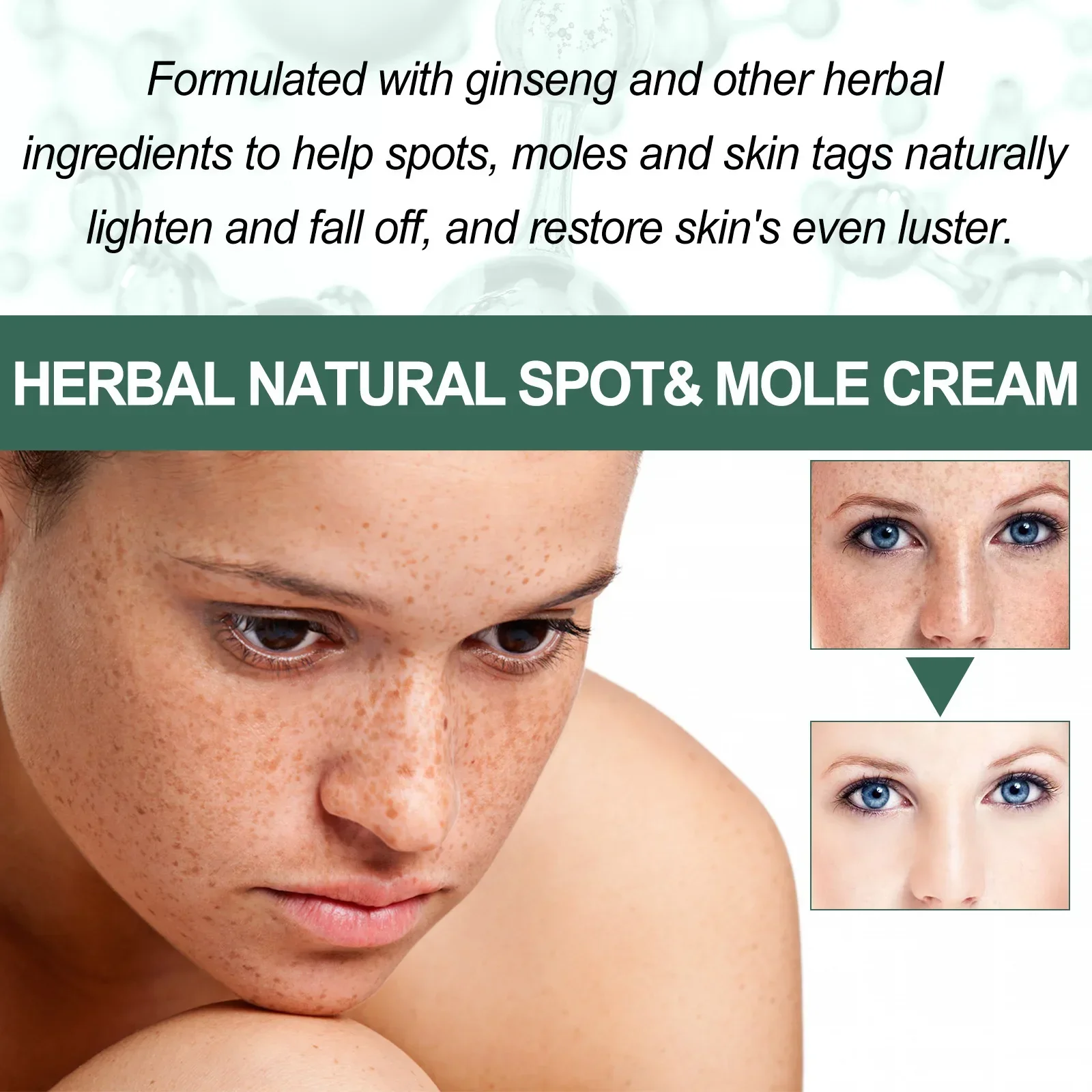 Sdatter Eelhoe Natural Spot Cream Spot Fading Acne Moisture Replacement Skin Whitening Gream Skin Whitening Freckle Removal Crea