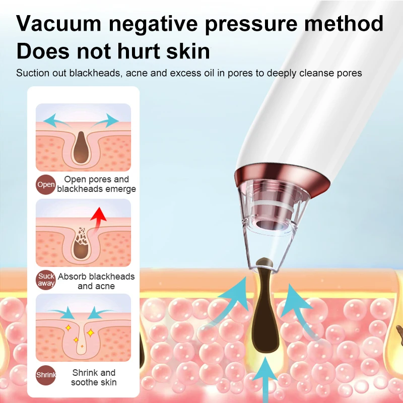 مزيل الرؤوس السوداء الكهربائية، منظف حب الشباب، إزالة البقع السوداء، تنظيف عميق للوجه، منظف المسام، أدوات العناية بالبشرة #3