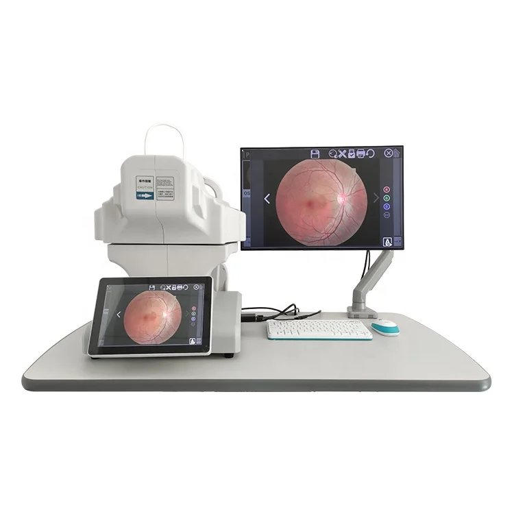 Computerized Eye Fundus Test Equipment Auto Digital Non-mydriatic Retinal Camera