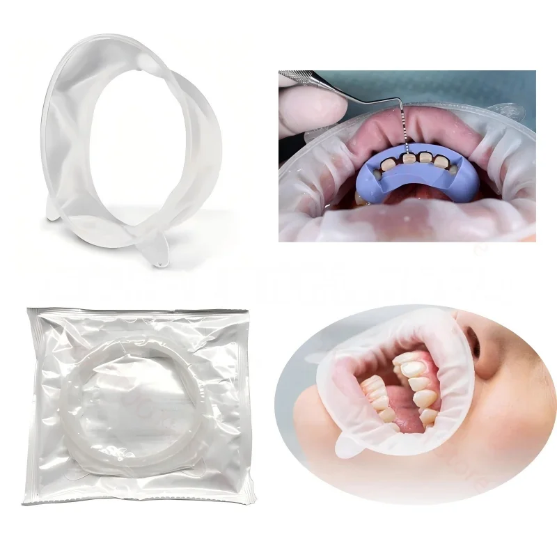 1Pc Dental Mouth Op… - image