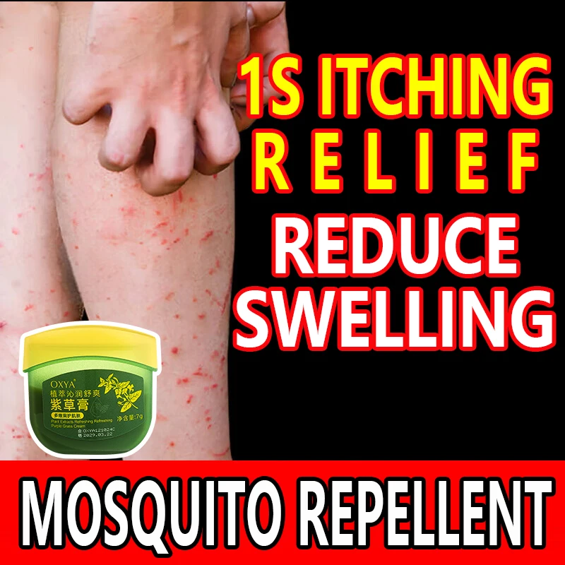 

Zicao ointment quickly relieves itching, reduces swelling, mosquitoes, and grass paste for babies, infants, and children