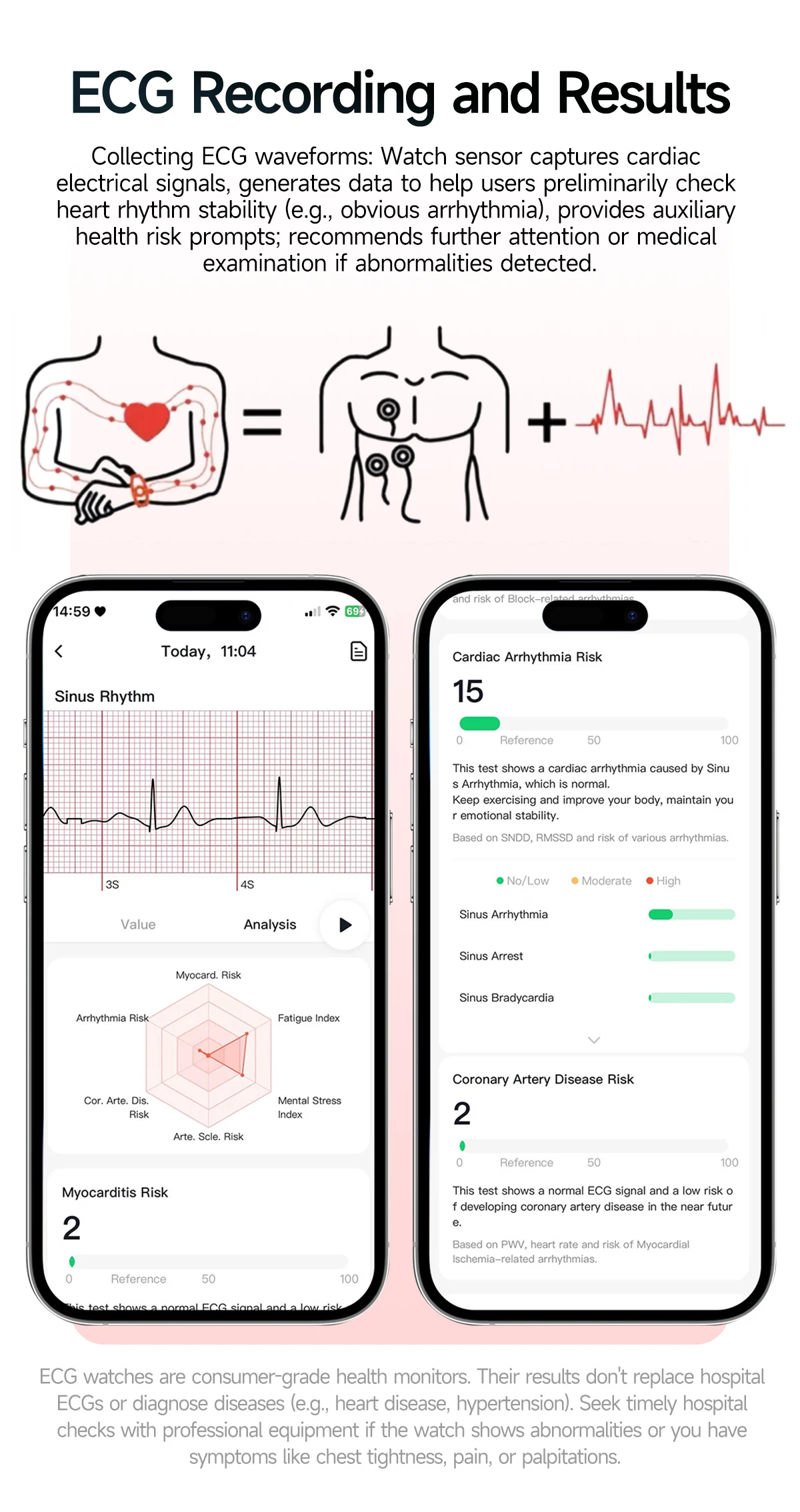 2026 Neue EKG+PPG Gesundheits-Diagnose Smartwatch für Männer Körperanalyse Blutdruck Lipid Harnsäure Frauen-Gesundheits-Tracker Smartwatch – Detail 8