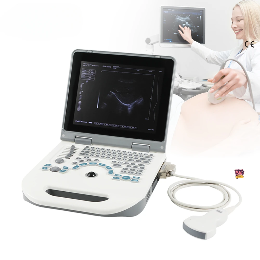 

Portable SUN-806G BW Full Digital Ultrasound Portable laptop Ultrasound Instrument