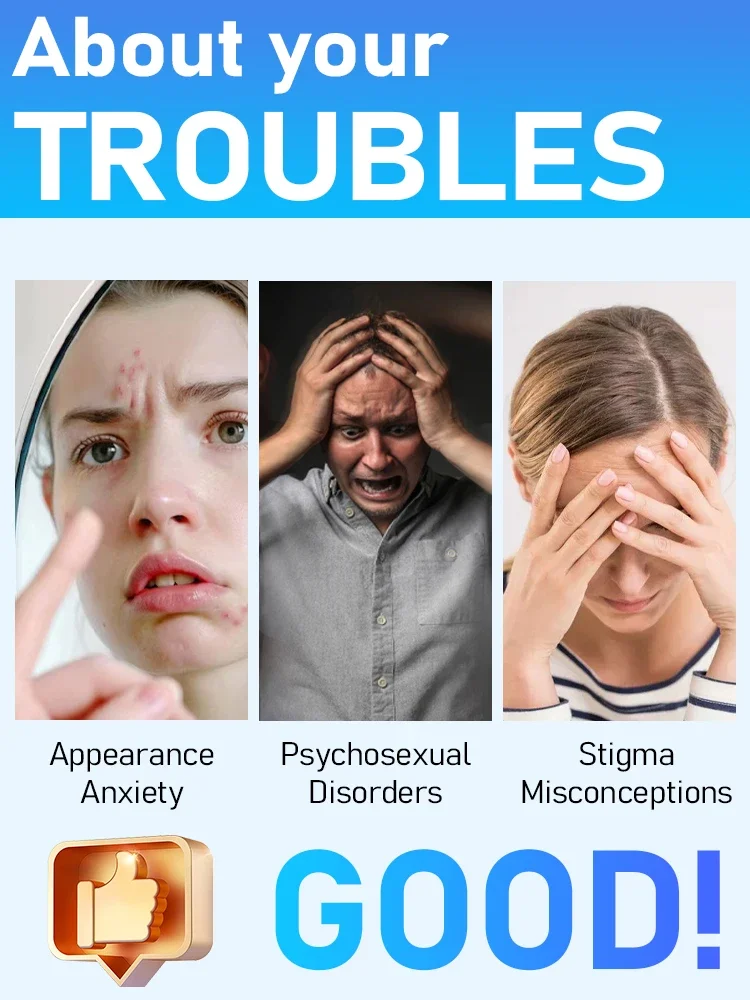 Penna a luce blu di vendita calda per risolvere le verruche del corpo, strumenti per la cura delle verruche