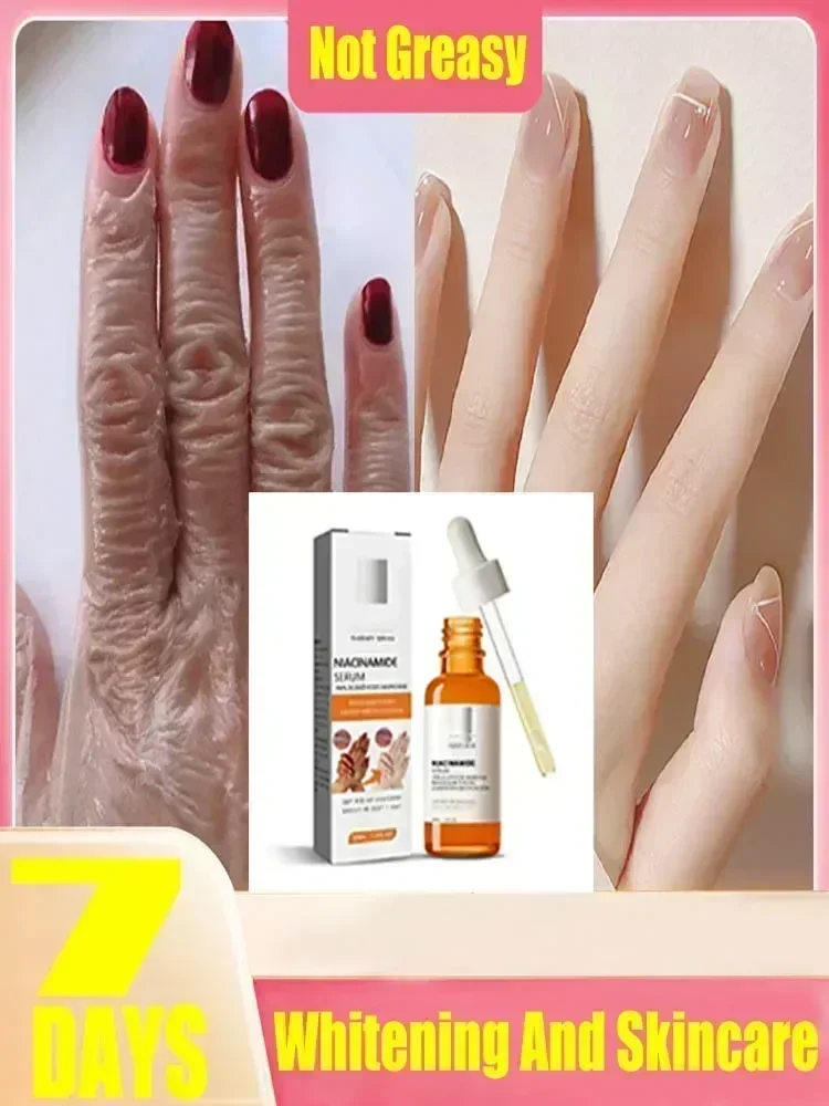 HOT~Dark knuckles whitening serum Elbows Armpit Beaching SerumWoman Private Part Skin Removal Dark Knuckles Strong Whitening Ser