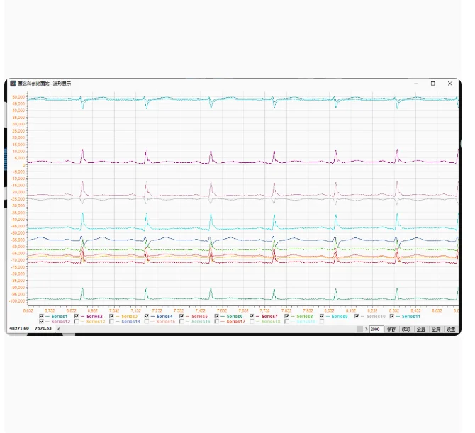 ADS1298 96 94 ECG Acquisition Module 12 Lead ECG Development Board STM32