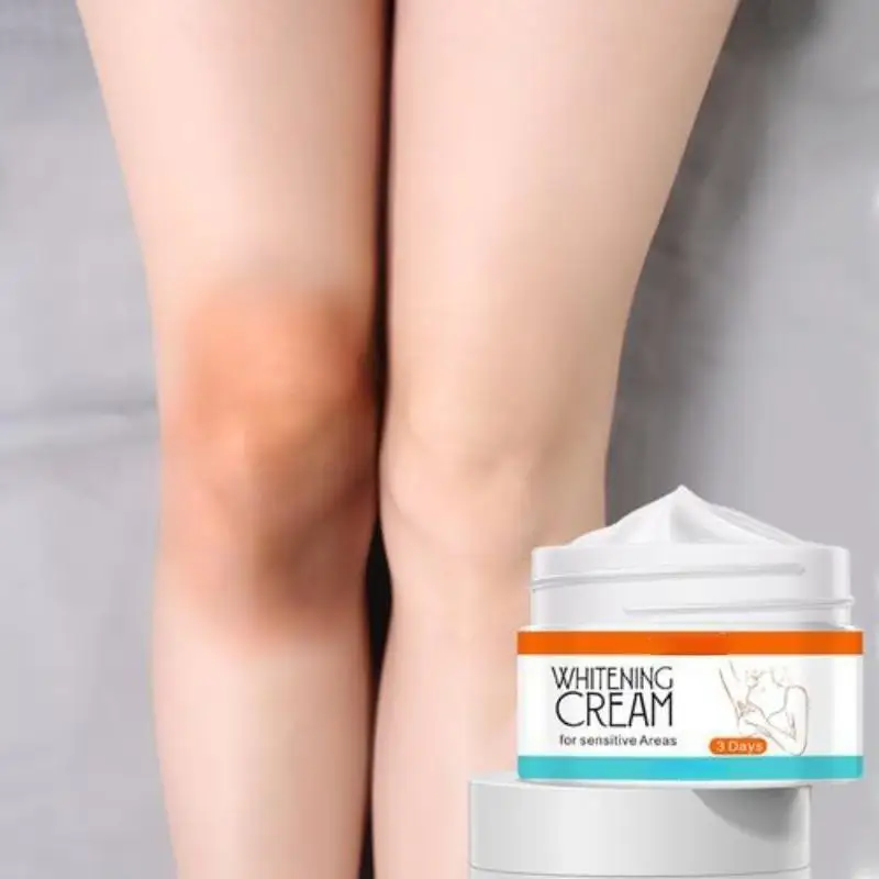 Bleaching Creme Unter Arm Dunkle Haut Beine Knie